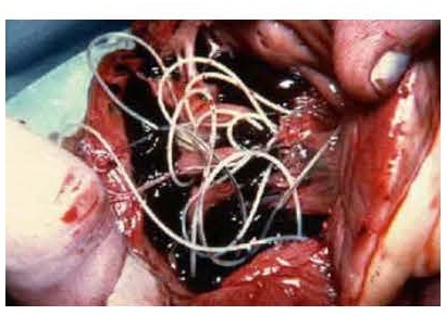Organes touchés par des parasites
